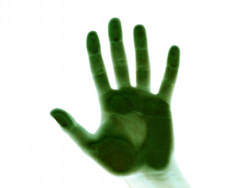 Die Hand